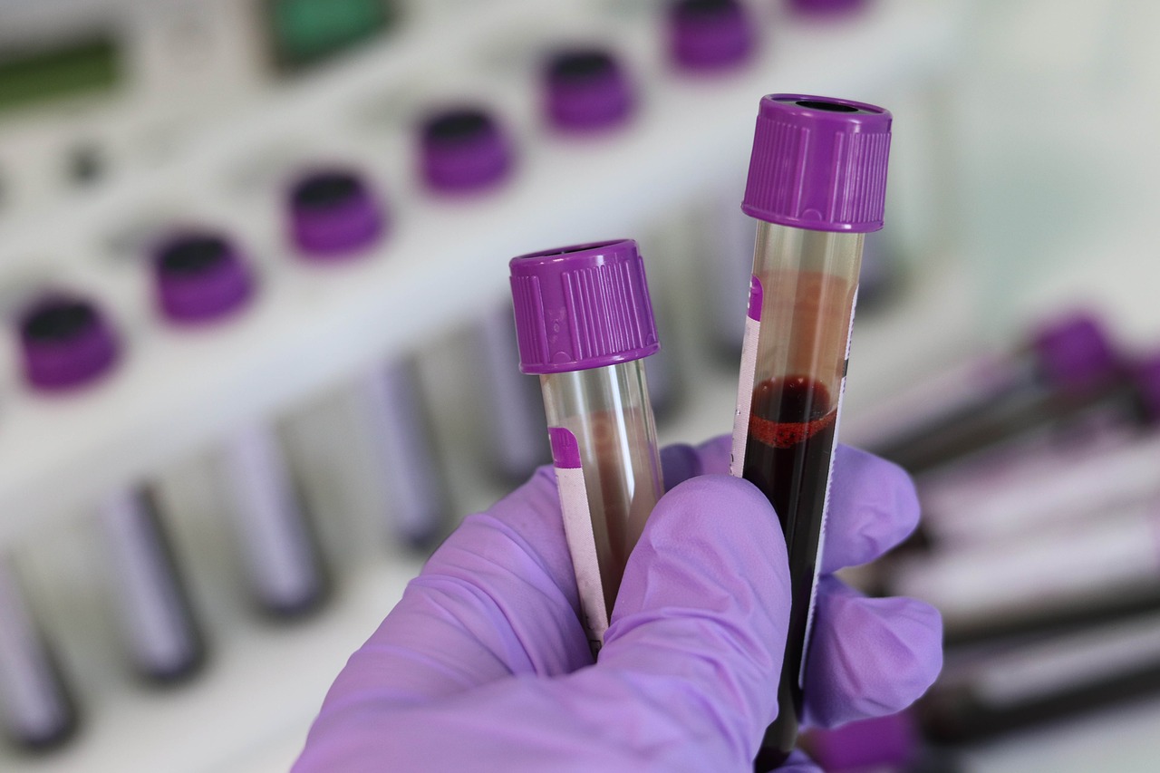 krew próbówka badanie koronawirus laboratorium - Pixabay