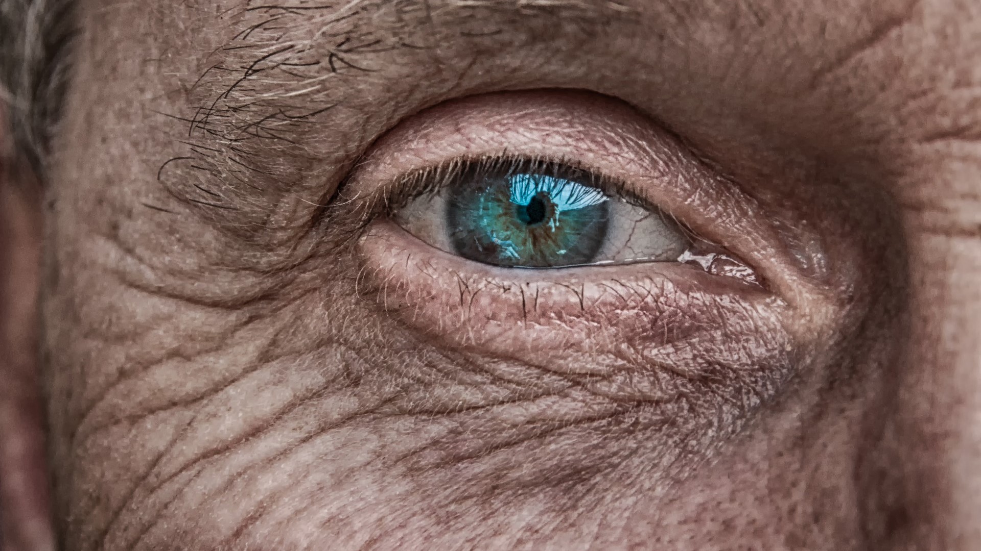 oko skóra - pixabay