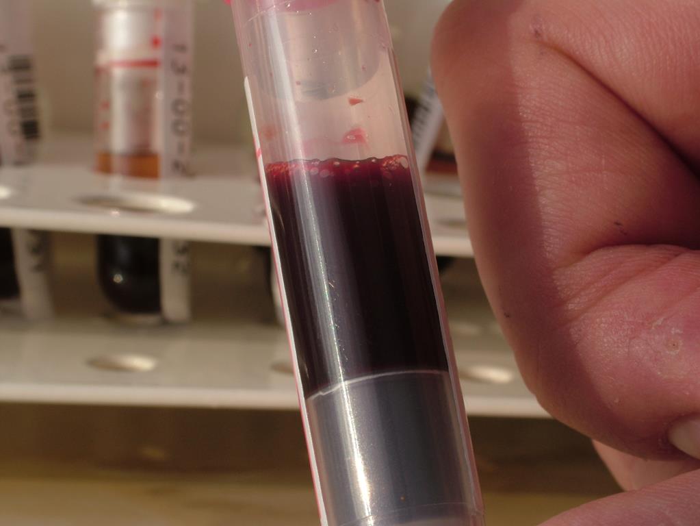 krew szpital próbka krwi - Wojtek Wardejn