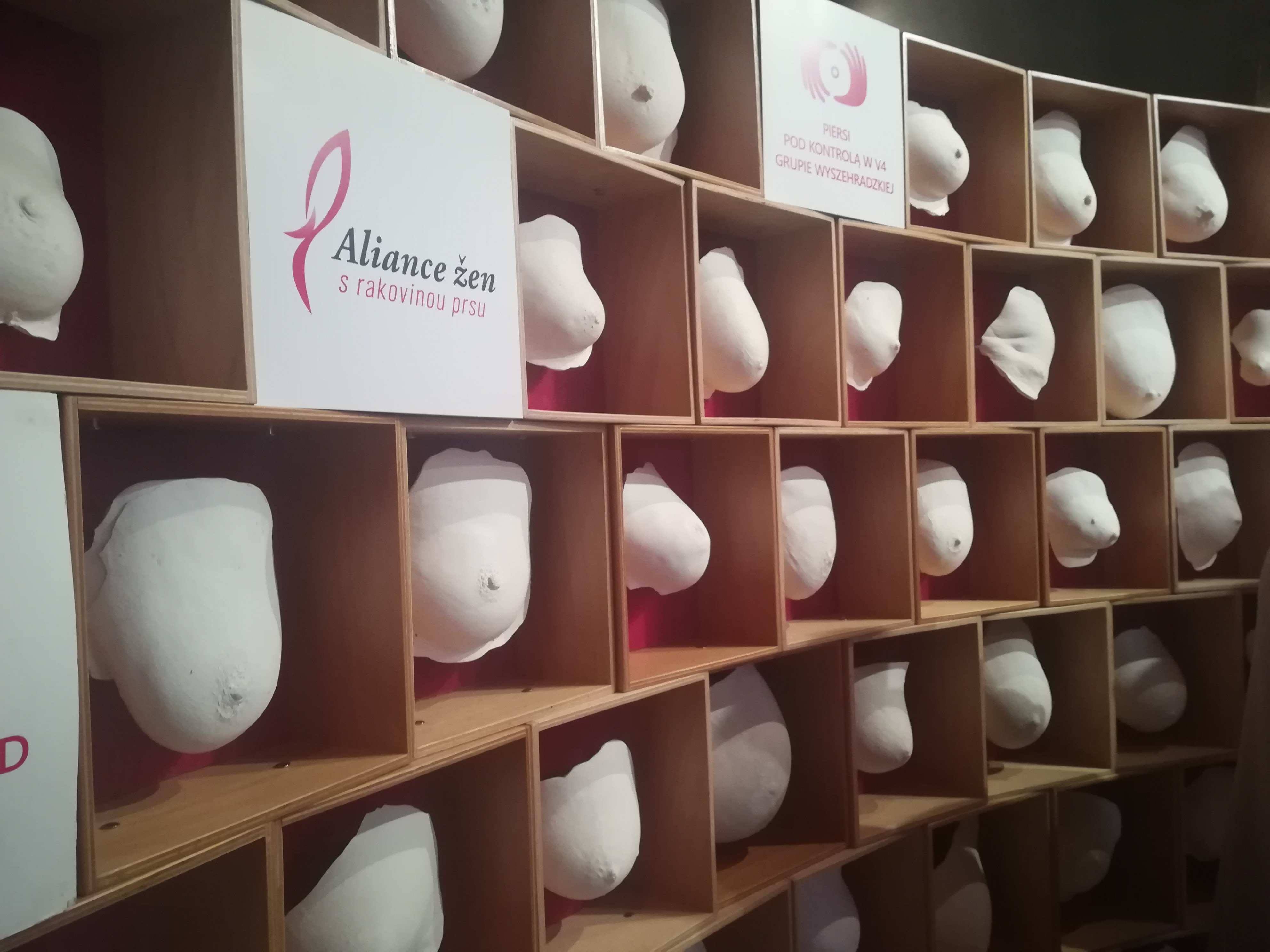 rak piersi model piersi odlewy kobiecych piesi - Sandra Soluk