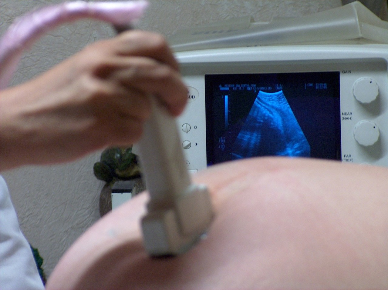 usg badanie ginekolog ciąża stock - Jess Lis - freeimages.com