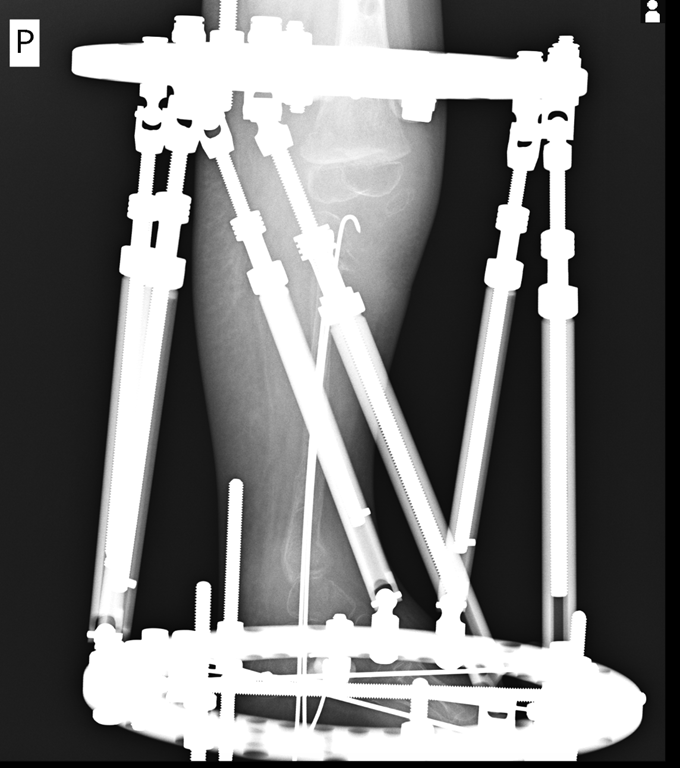 Szpital Kliniczny im. Wiktora Degi
