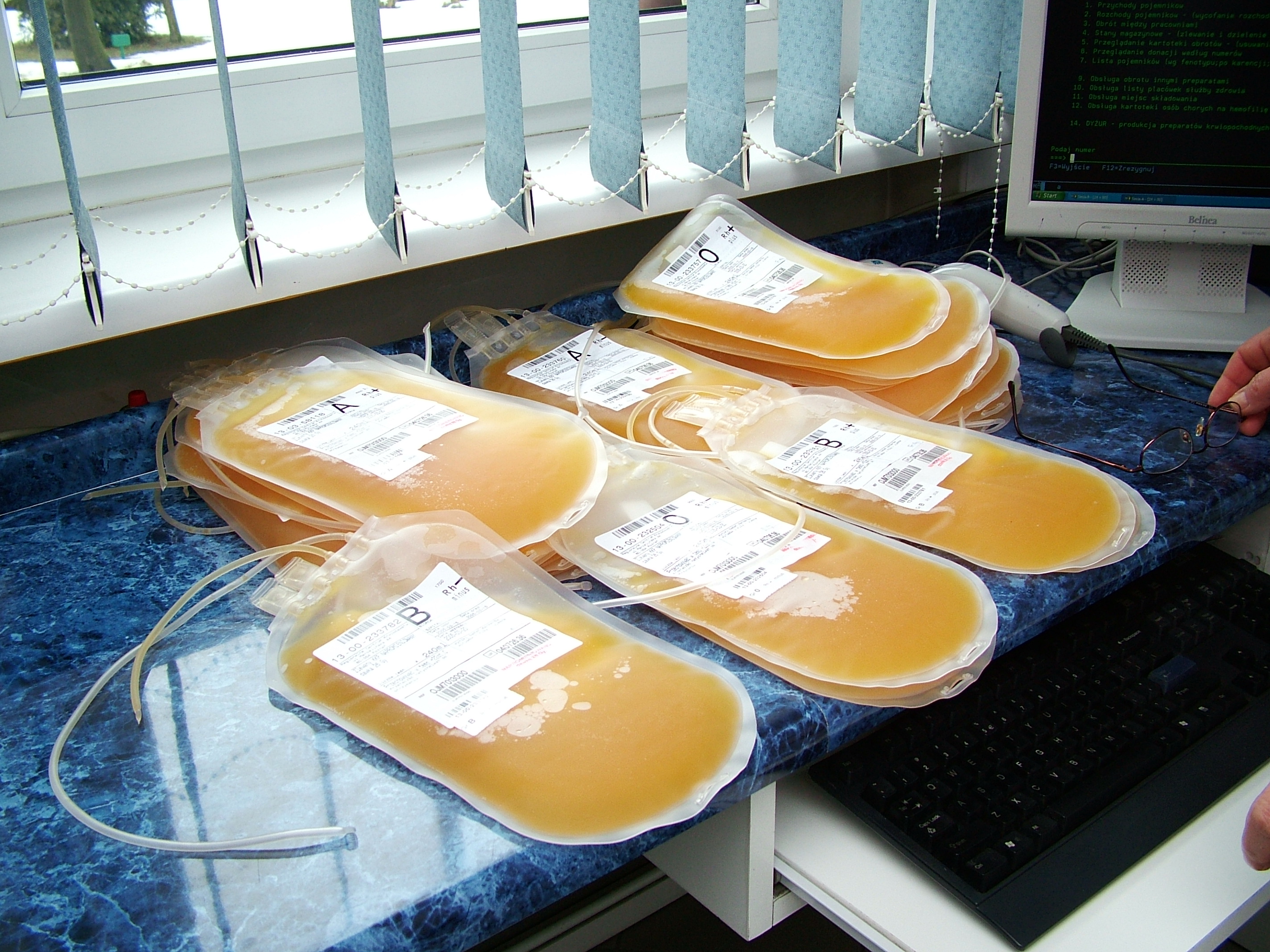 osocze - Wojtek Wardejn