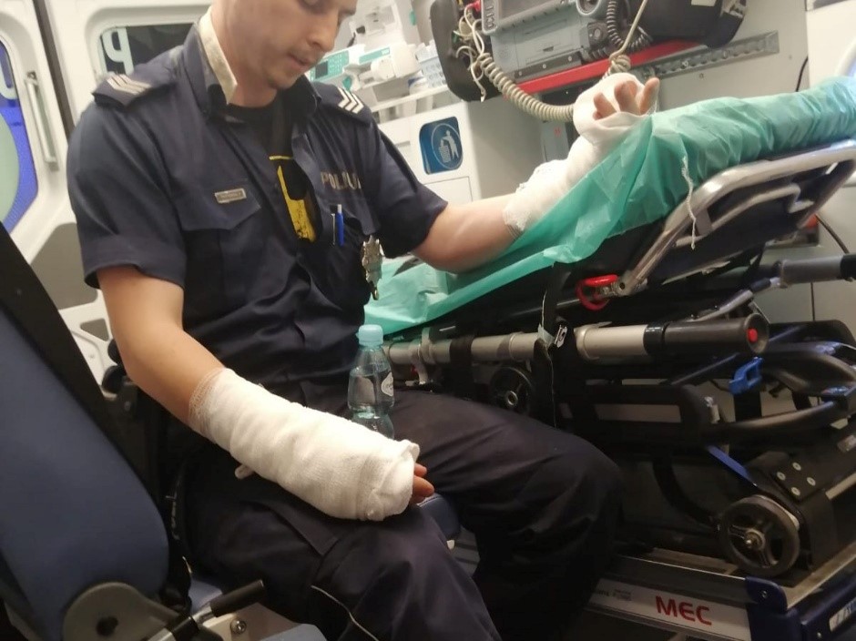 poparzony policjant ostrzeszów  - KPP Ostrzeszów