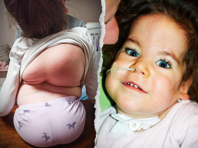 pomoc ani karolewicz siepomaga - siepomaga.pl