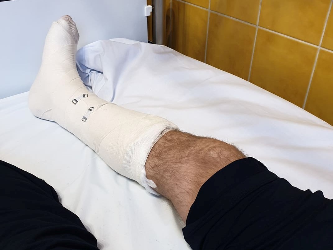 jacek jaśkowiak złamana noga  - FB: Jacek Jaśkowiak