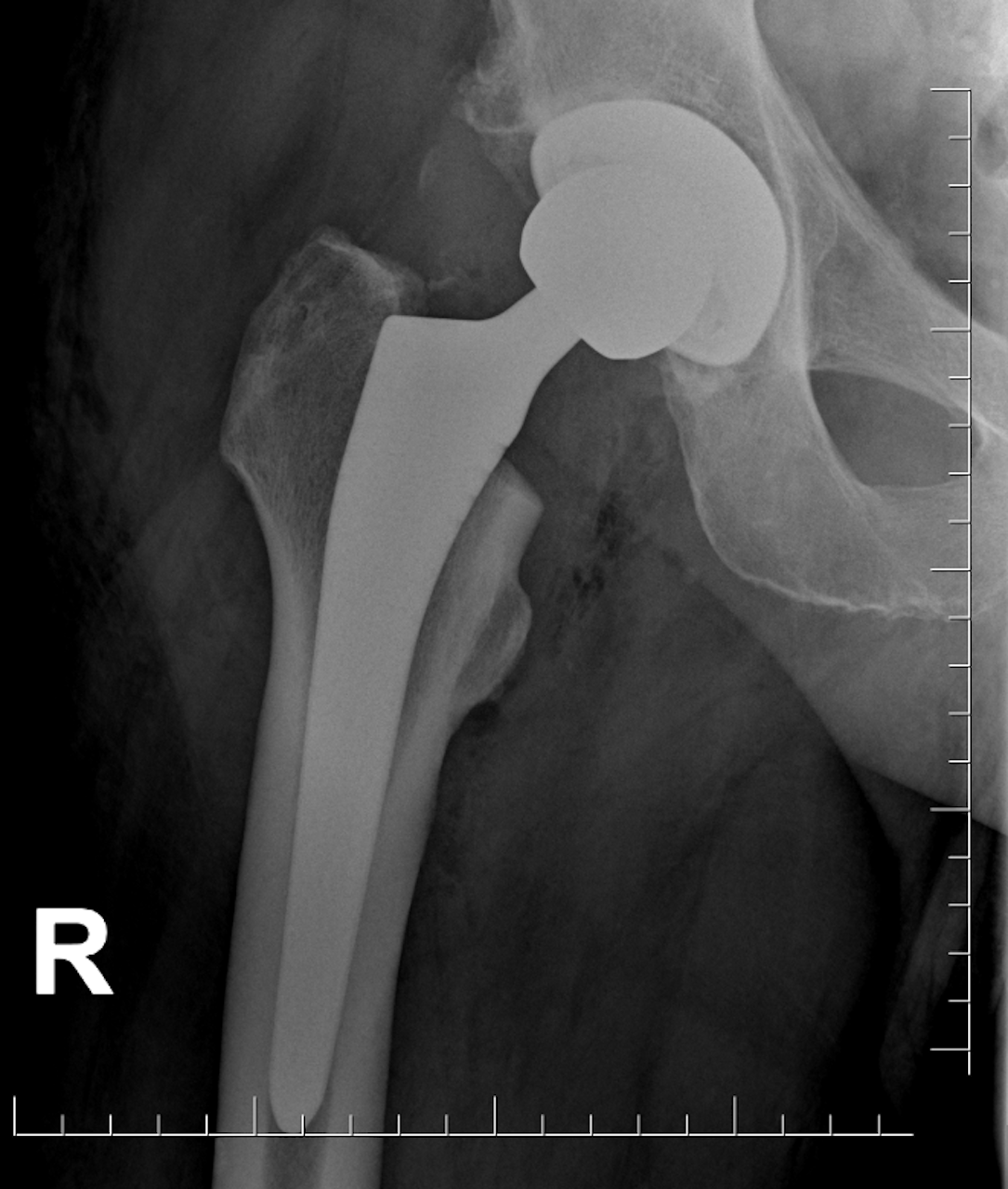 Szpital im. Wiktora Degi w Poznaniu