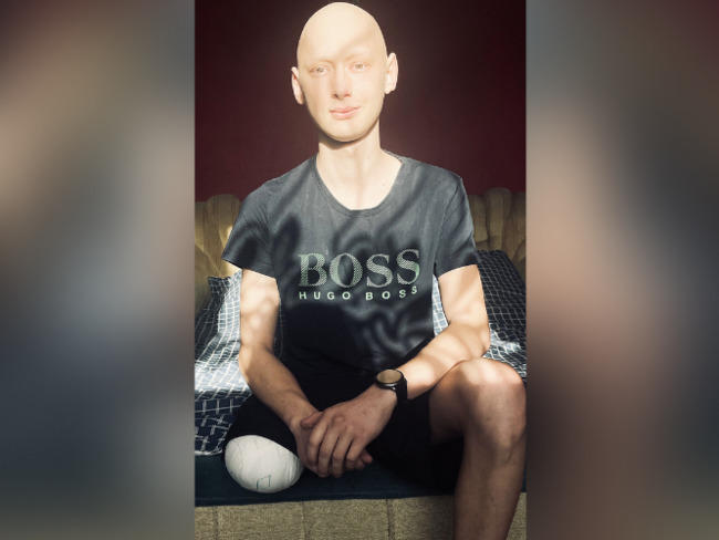 PROTEZA NOGI KAMIL JÓŹWIAK UNIA LESZNO - siepomaga.pl