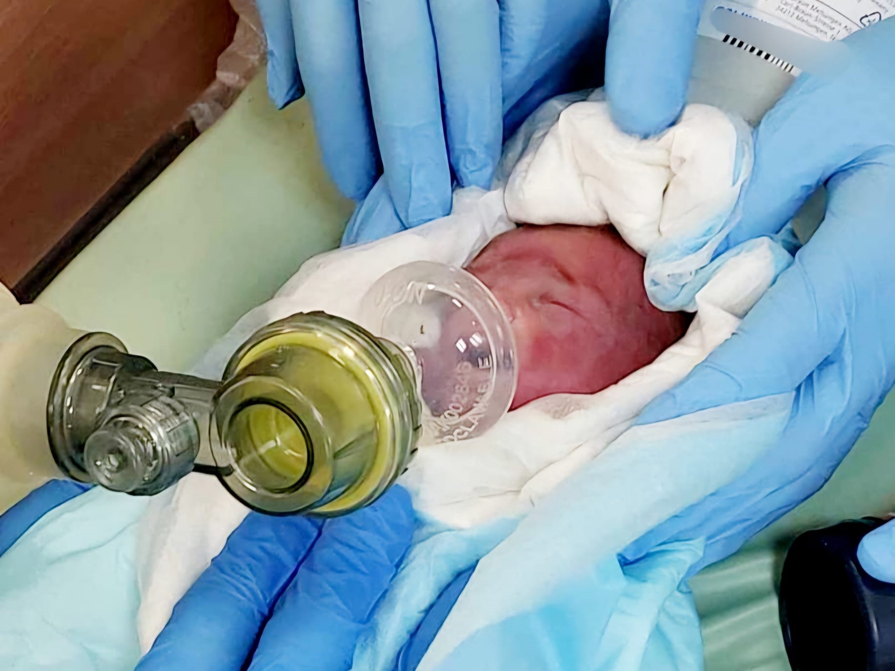 Szpital Miejski im. J. Strusia Szwajcarska Poznań  poród wcześniak - Szpital Miejski im. J. Strusia Szwajcarska Poznań 