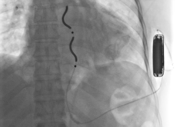 Operacja - Miejski Szpital im. Strusia