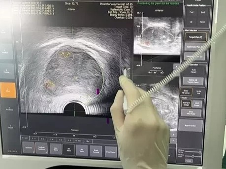 mona lisa szpital wojewódzki  - Szpital Wojewódzki w Poznaniu