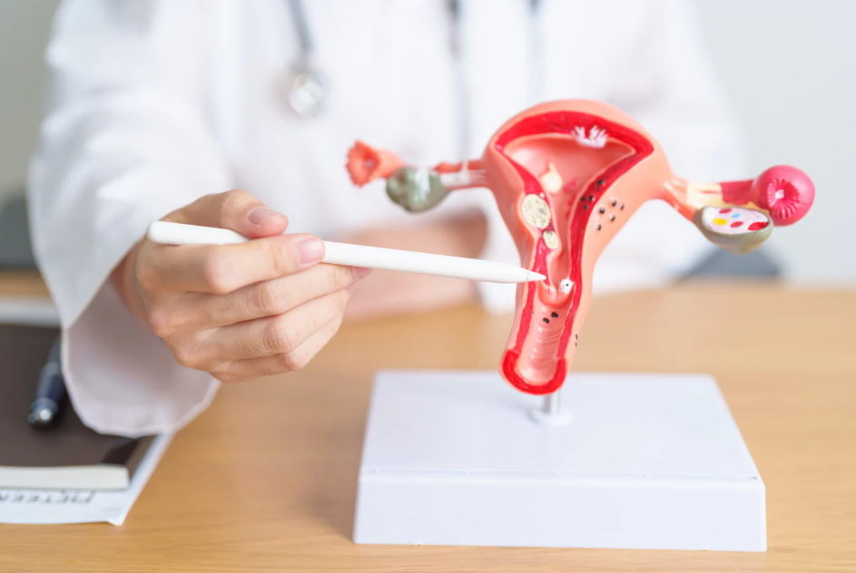 Endometrioza - Getty images