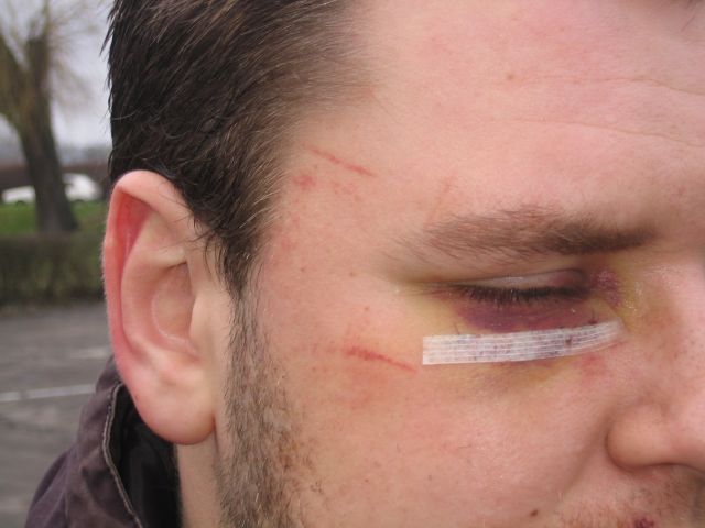 pobici przez policję - Rafał Muniak