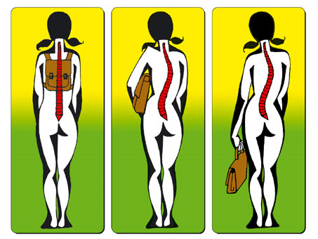 Wady postawy plakat - Wady postawy