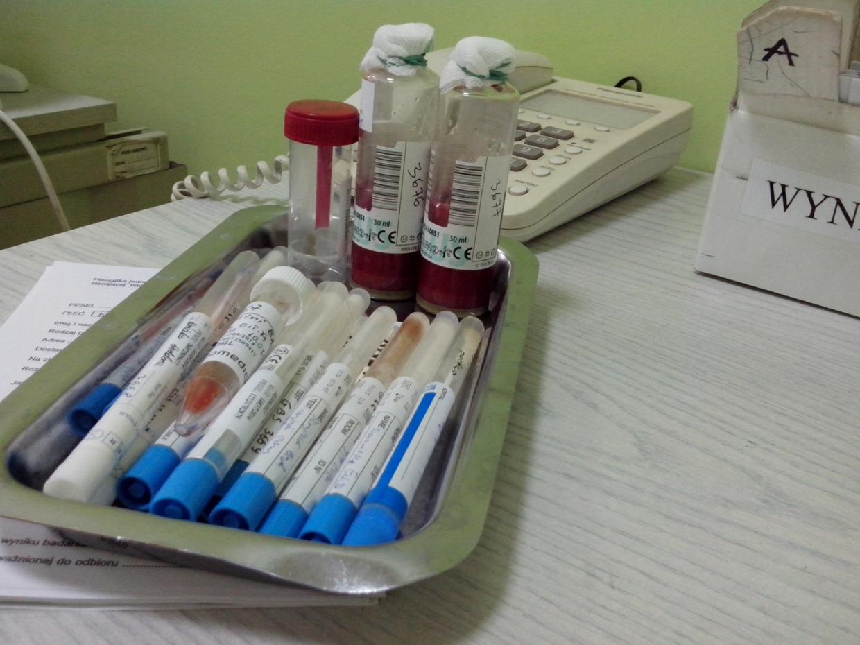 preparaty probówki - Jacek Butlewski